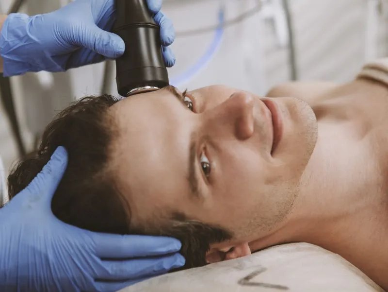 男士祛痘印的方法有哪些