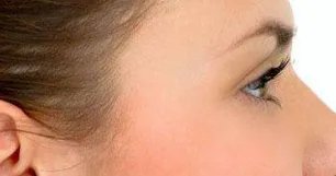 玻尿酸丰太阳穴价格