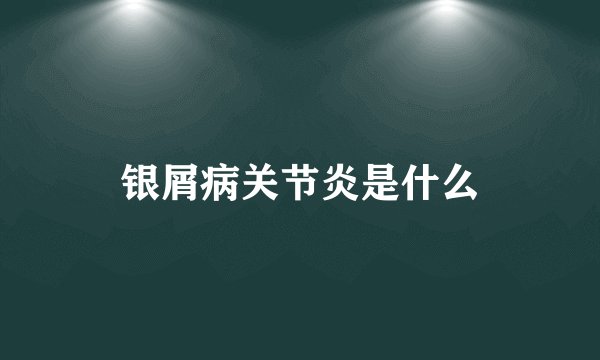 银屑病关节炎是什么