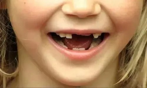 贾静雯晒全家照，掉牙的波妞喜感十足，孩子一般几岁就开始掉牙了？