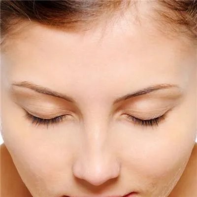 怎么去眉间纹