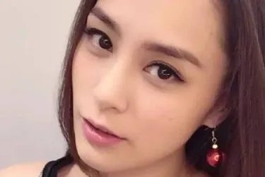 阿娇受伤后首露面，是否存在故意遮挡伤口的行为？