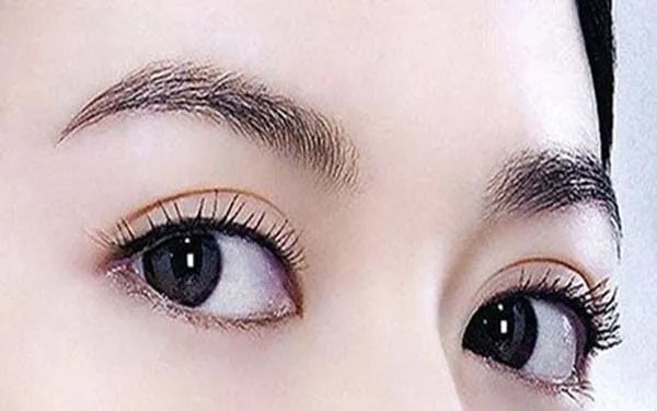 成都开眼角去哪家医院好