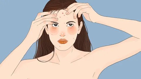 脸上痘坑怎么去除