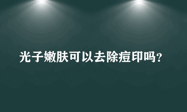 光子嫩肤可以去除痘印吗？