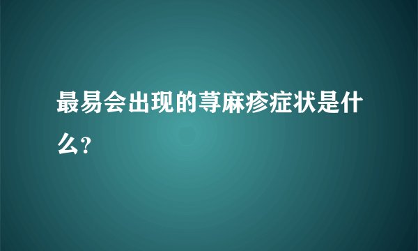 最易会出现的荨麻疹症状是什么？